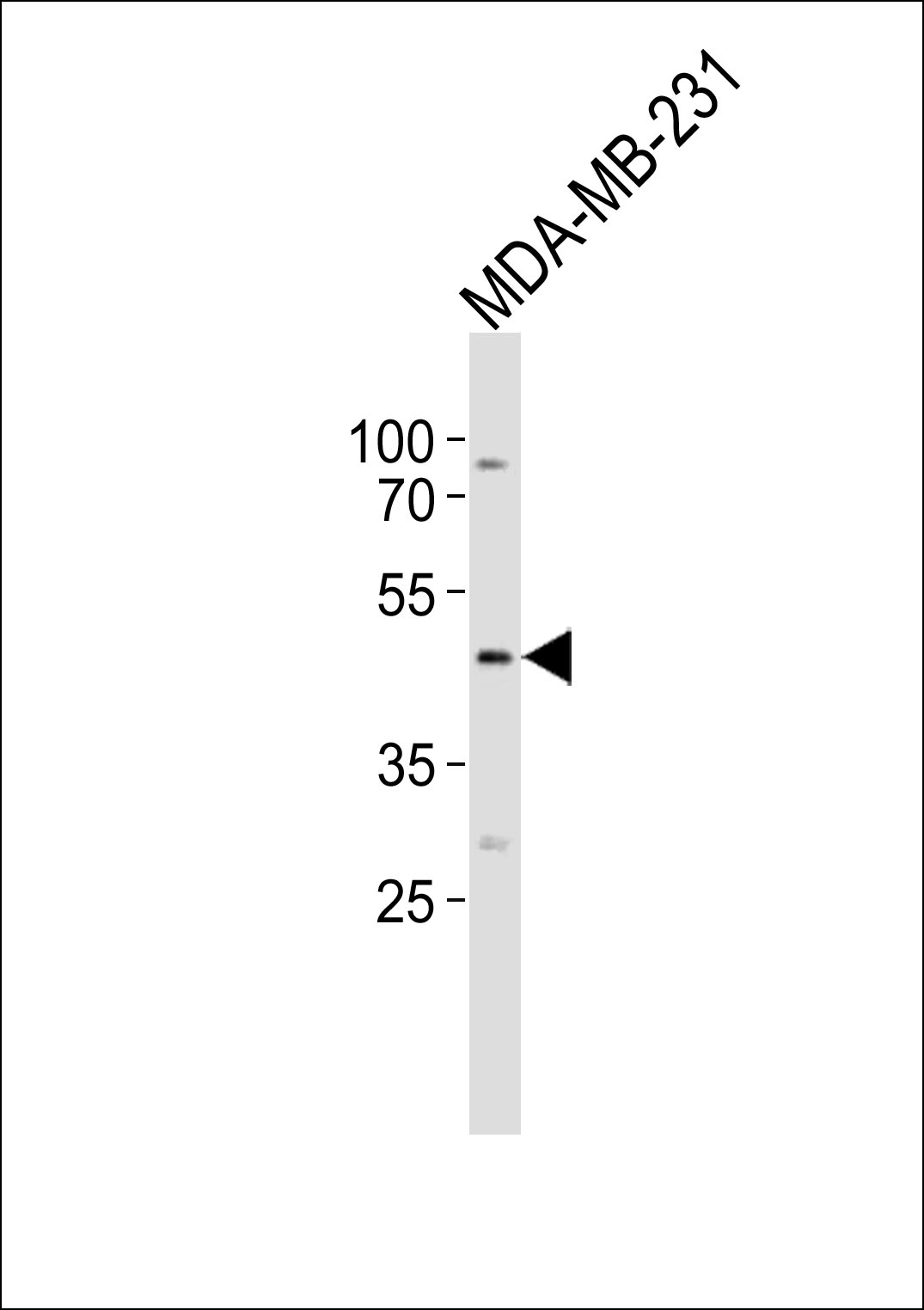 EDG4 (N-term)
