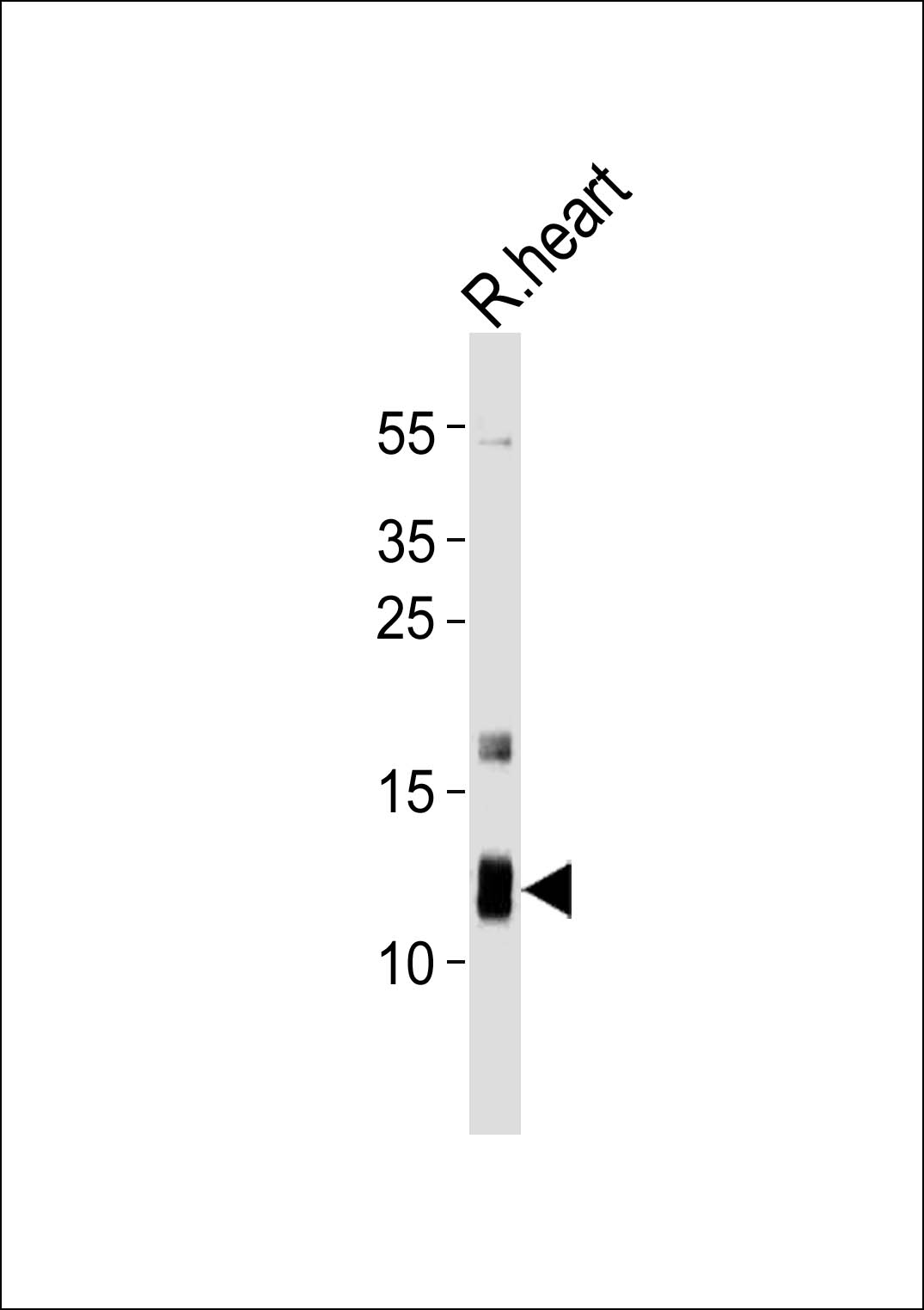 ATP5J
