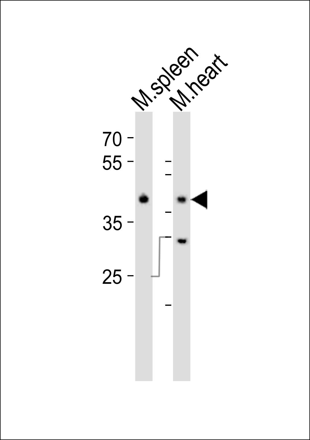 Mouse Mapk11 (N-term)