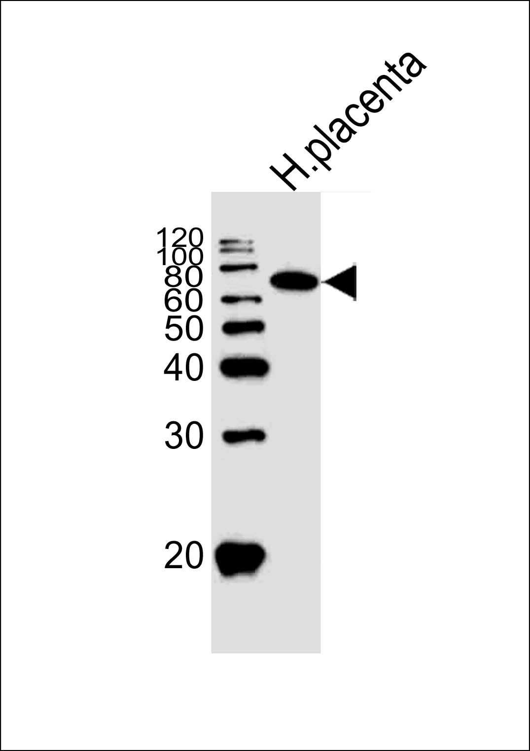 Alkaline Phosphatase (ALPI)