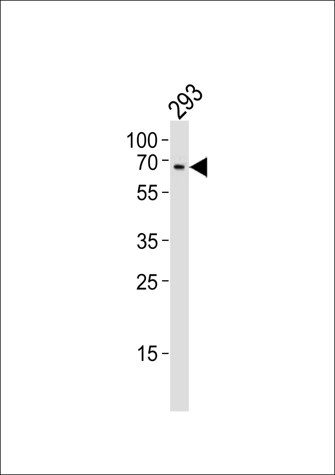 TESK1