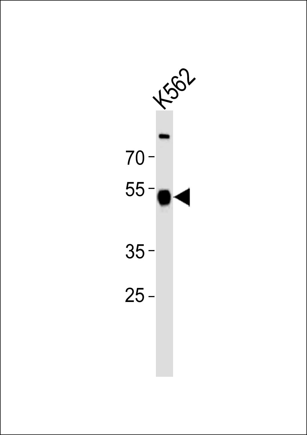 ZNF500 (N-term)