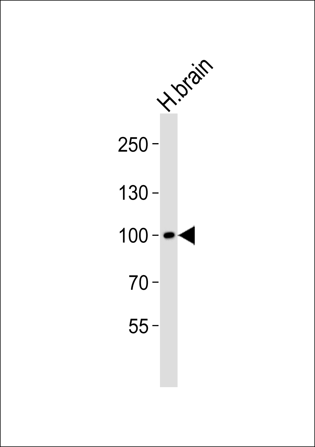 Rabbit Polyclonal Antibody to Mouse Ddr1