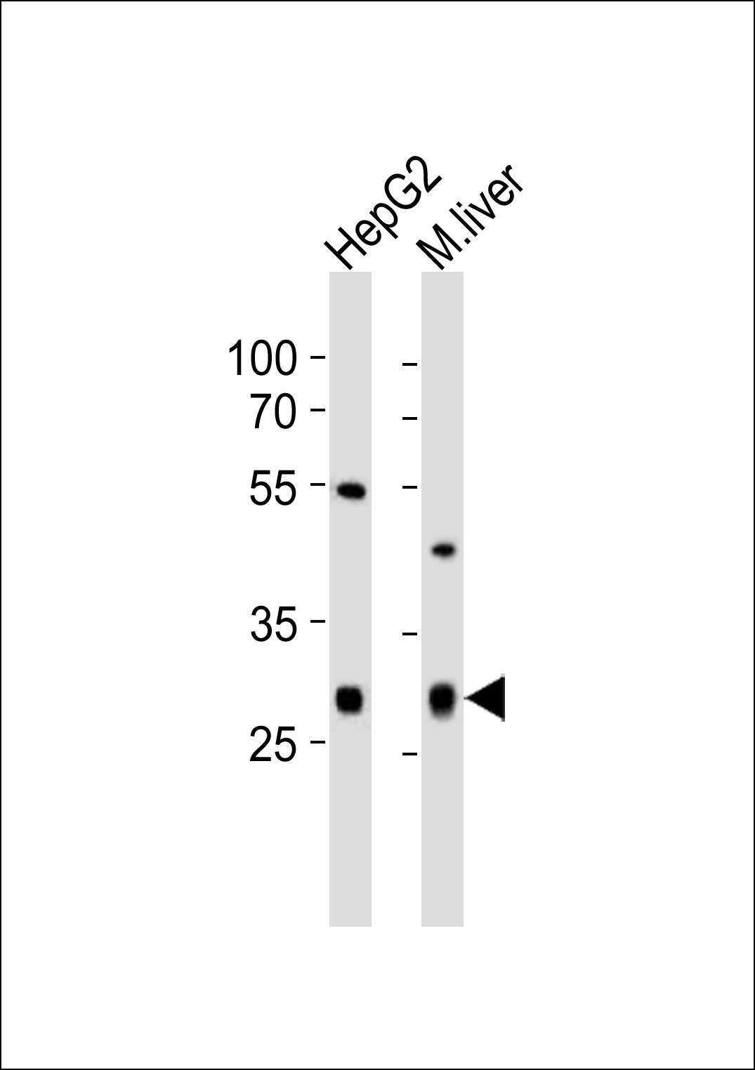 CTDSP1 (N-term)