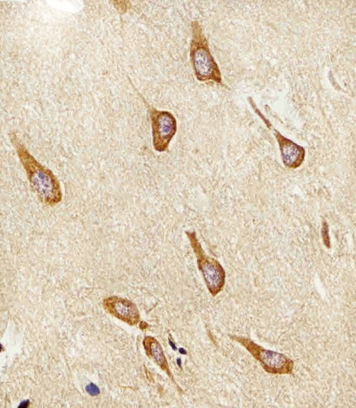 Rabbit Polyclonal Antibody to PAFAH1B1 (N-term)