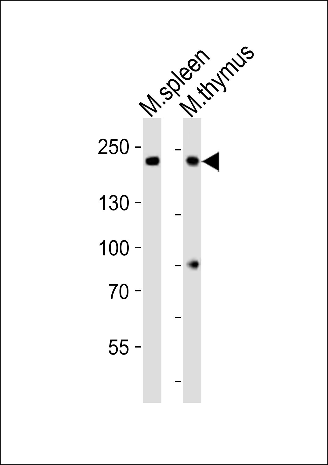 (Mouse) Zcchc11