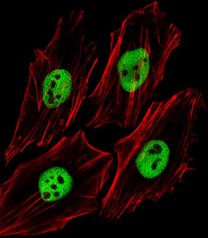 Rabbit Polyclonal Antibody to (Mouse) Trim24