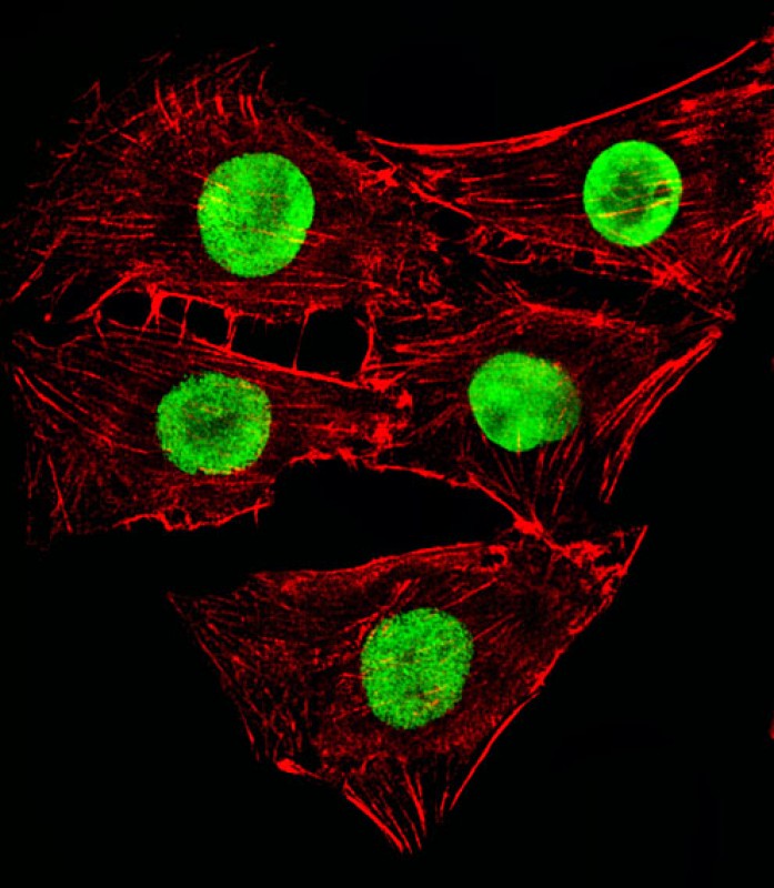 Rabbit Polyclonal Antibody to Mouse Hmga2