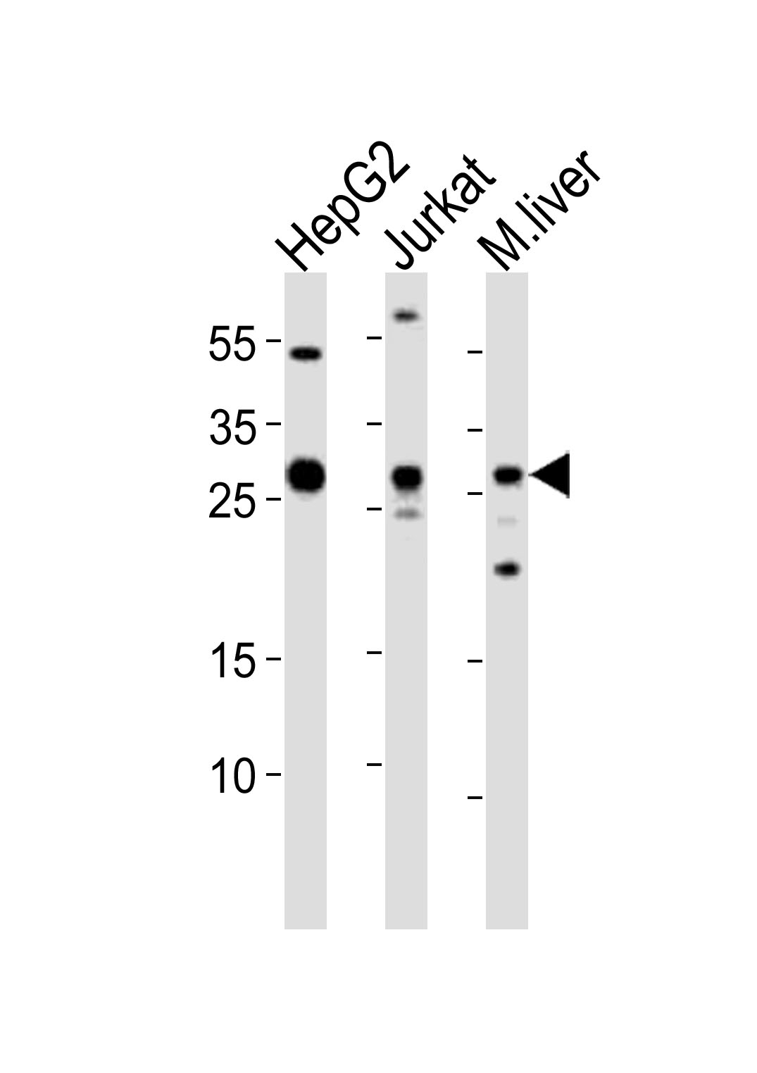 CTDSP1