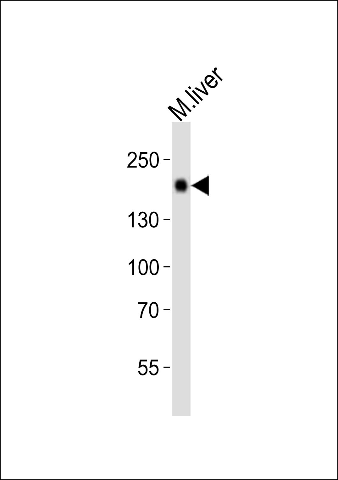 Mouse Egfr (P1116)
