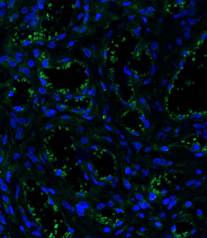 Rabbit Polyclonal Antibody to CD34