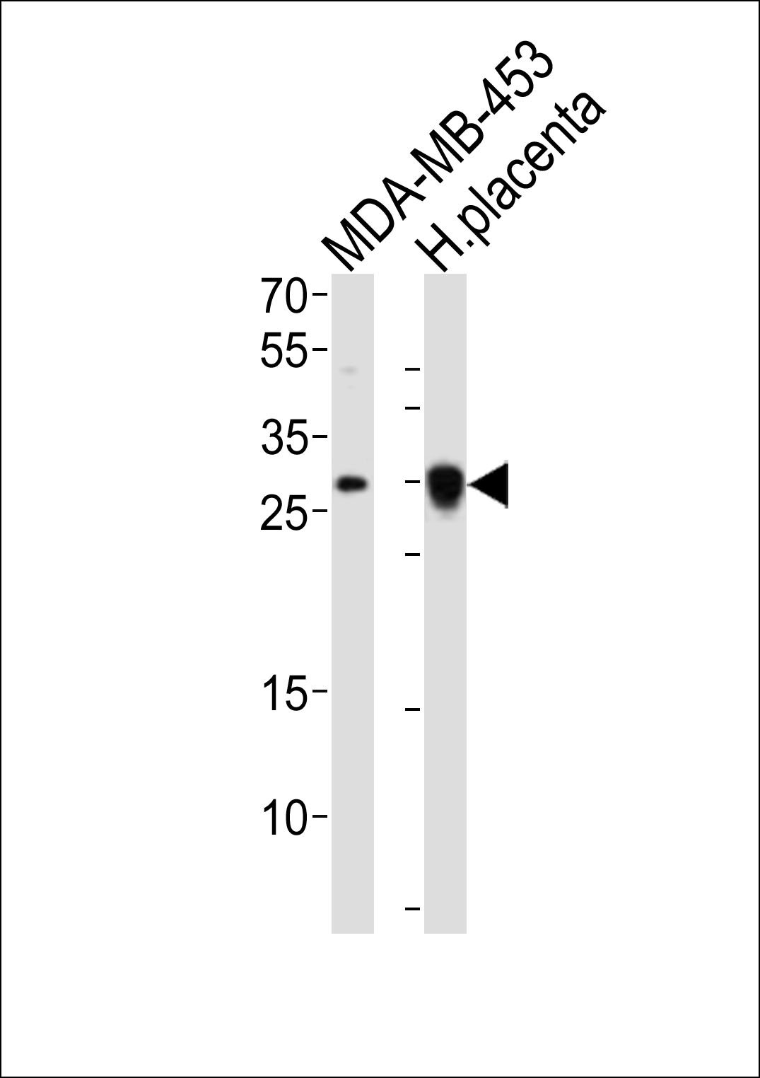 FOLR2 (N-term)