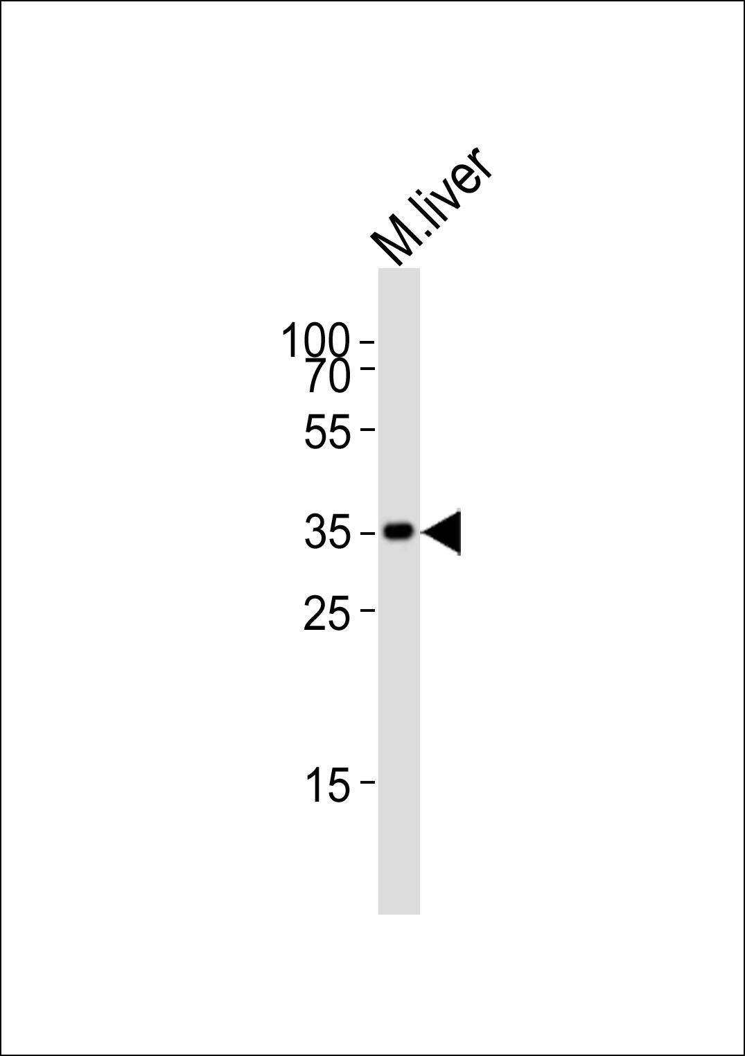 HMX2