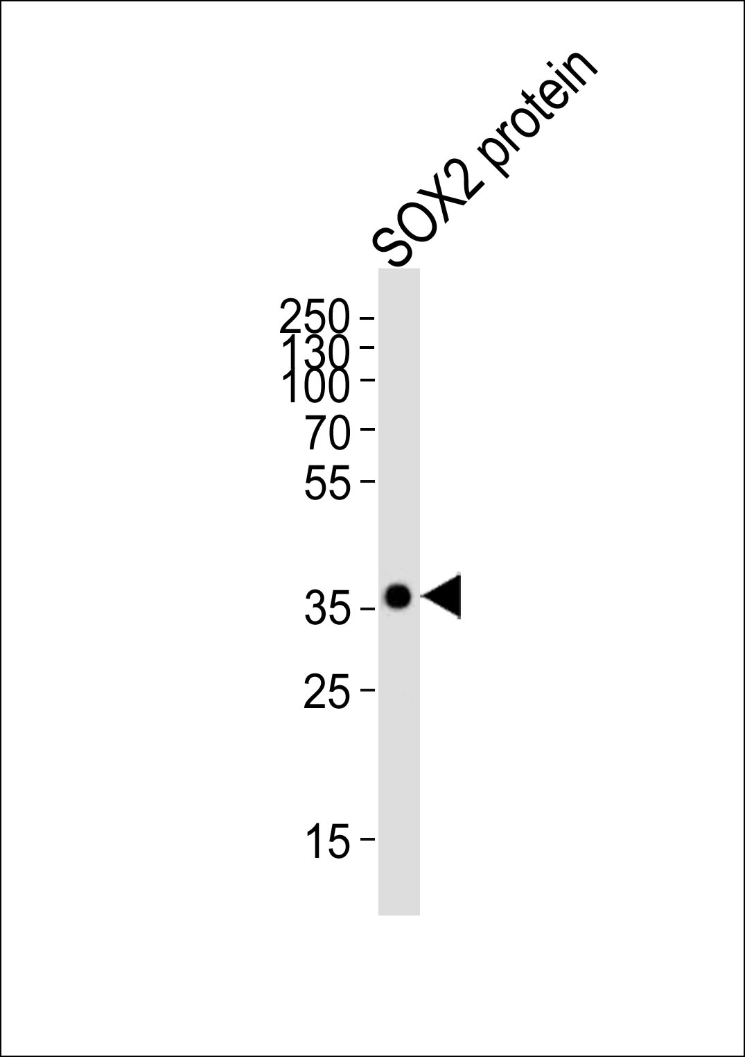 SOX2