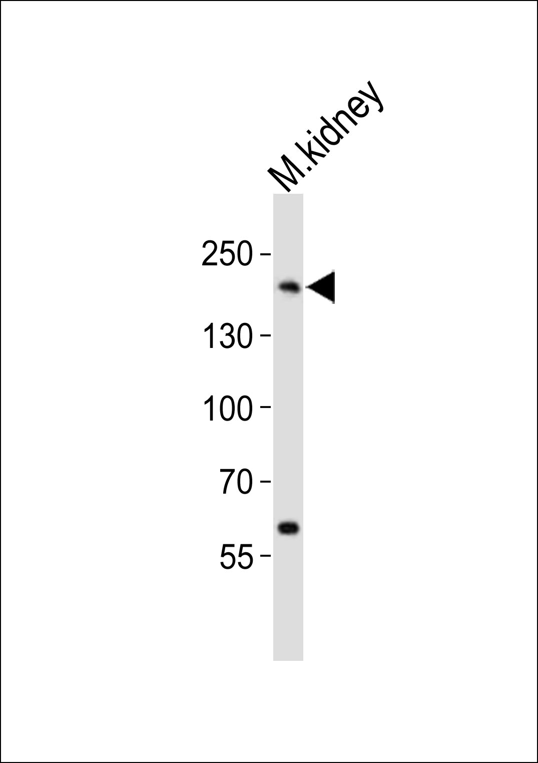 Mouse Erbb2 (P1142)