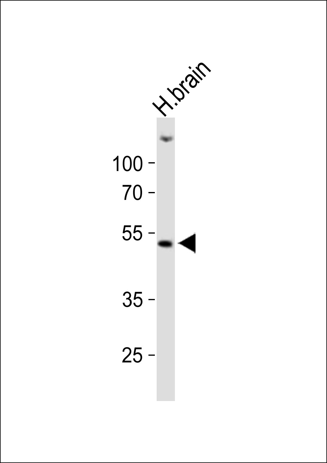 HCRTR1