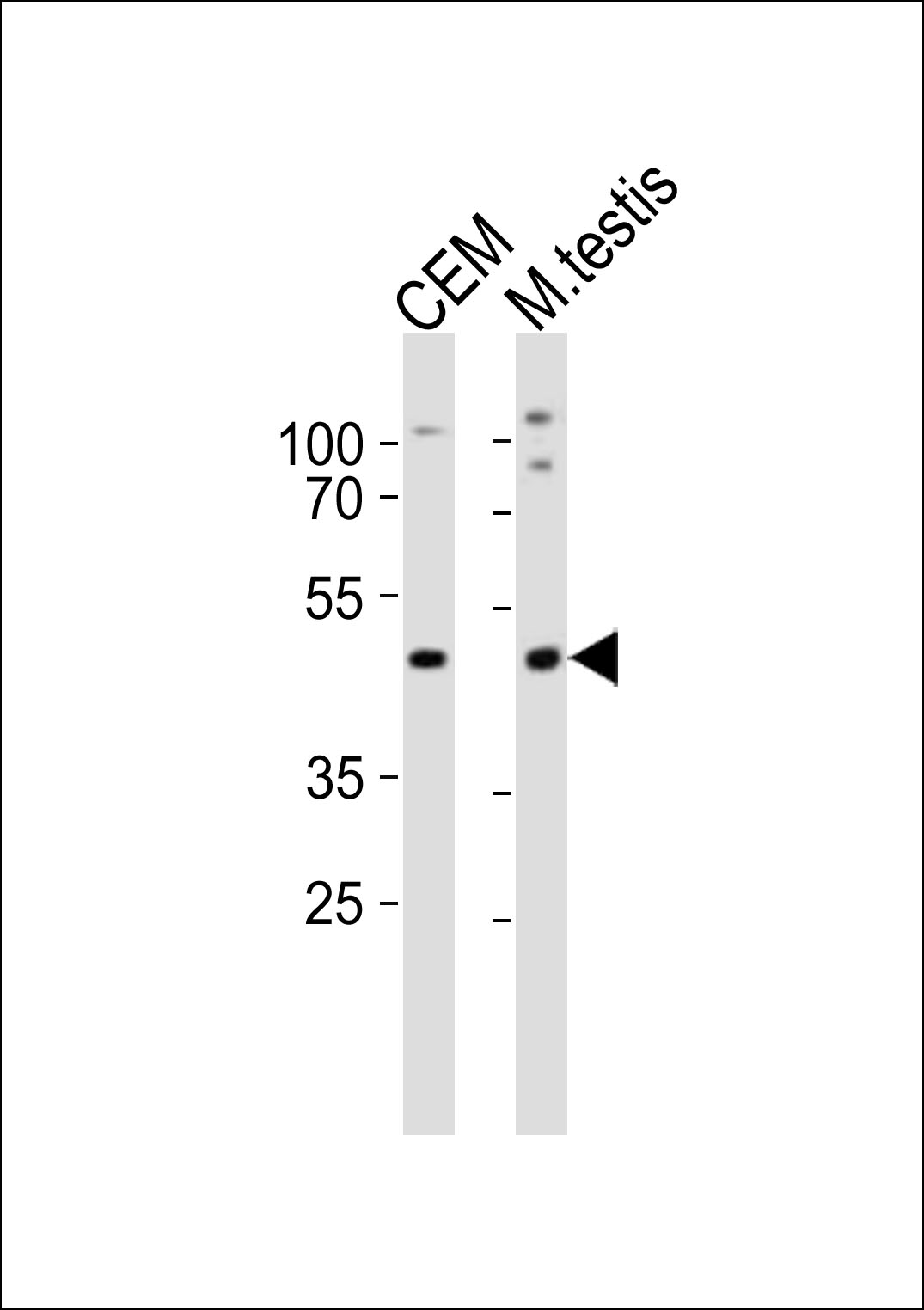 Mouse Lhx1