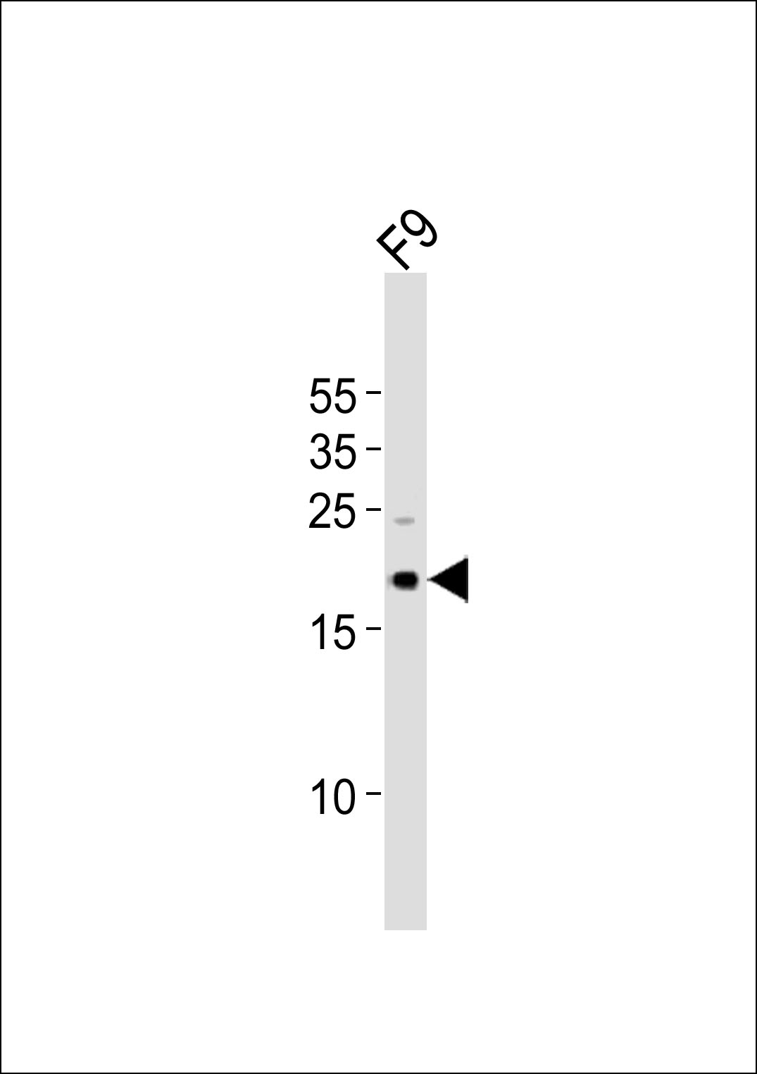 (Mouse) Tdgf1 (N-term)