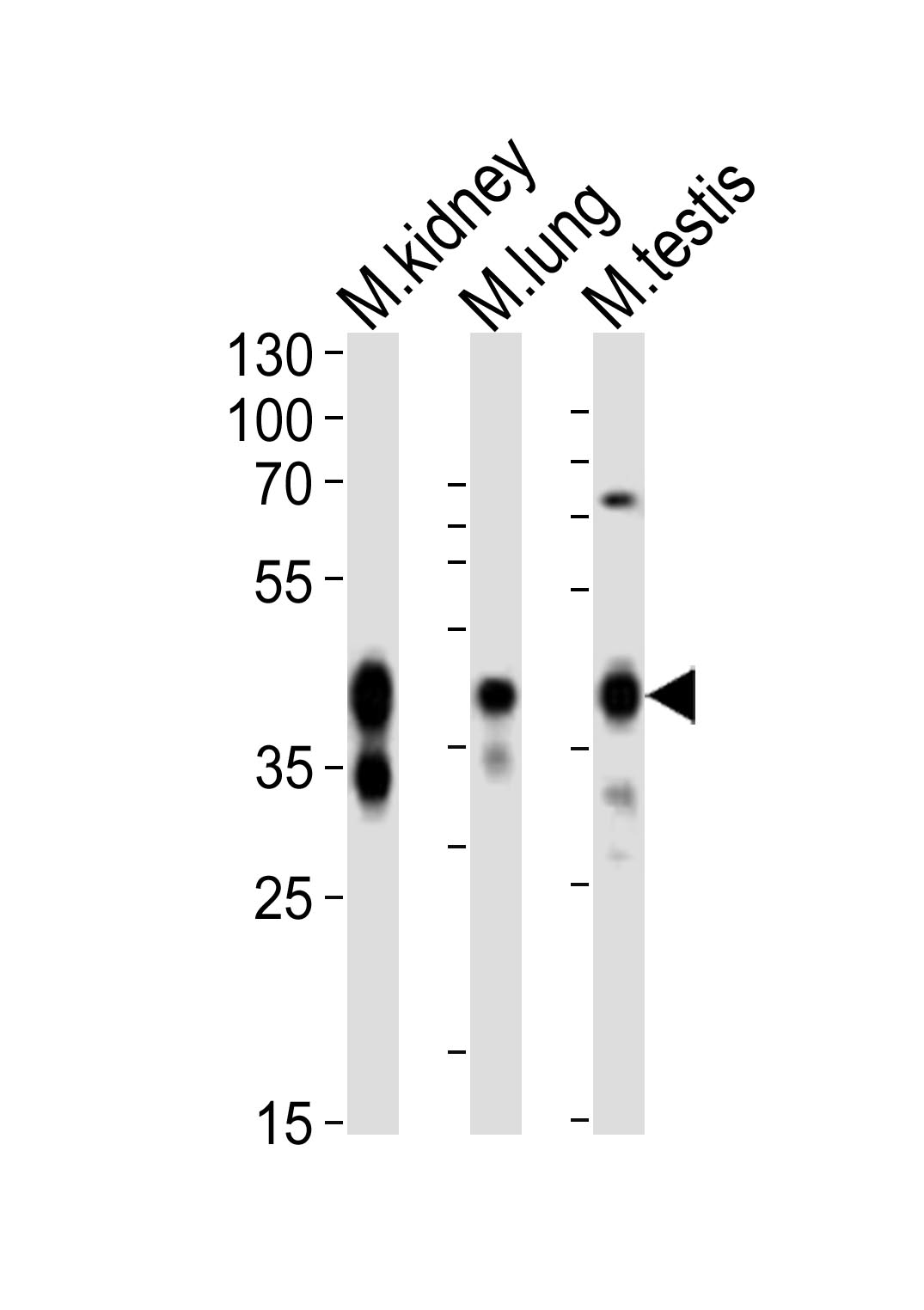 (Mouse) Epcam