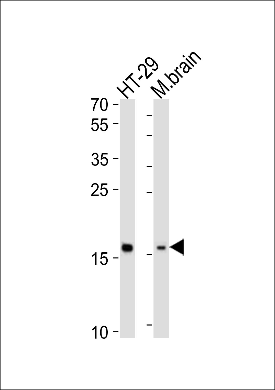 TMEM160  (N-term)