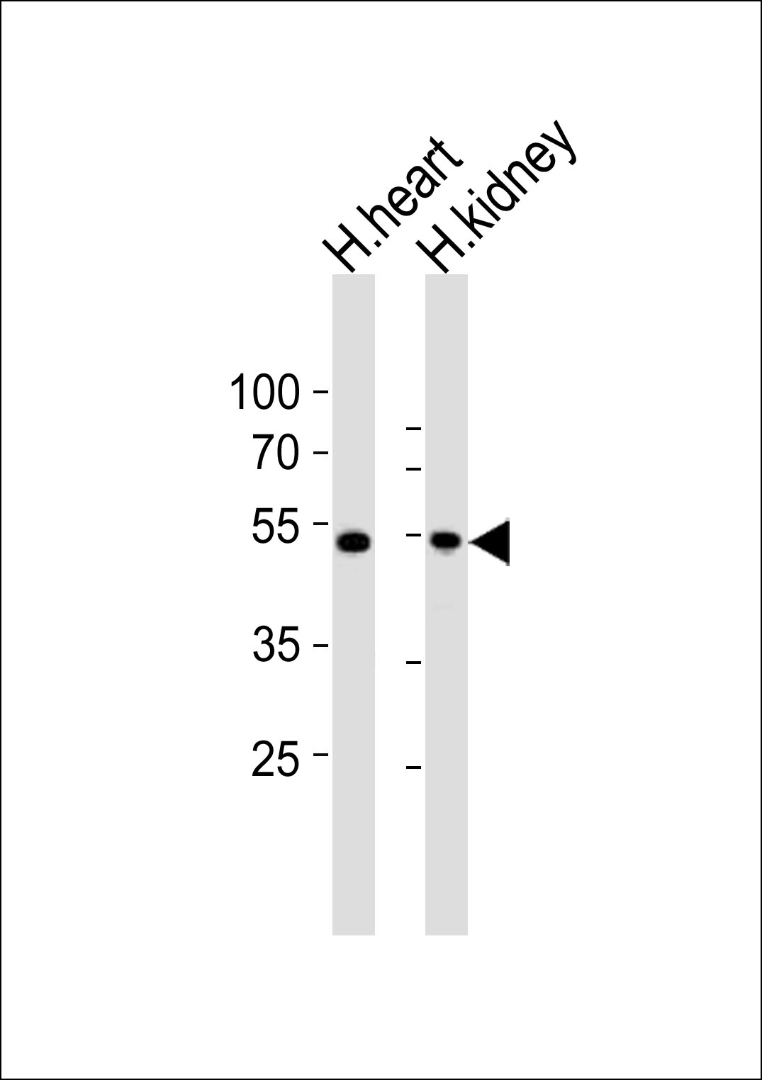 ST3GAL2 (N-term)