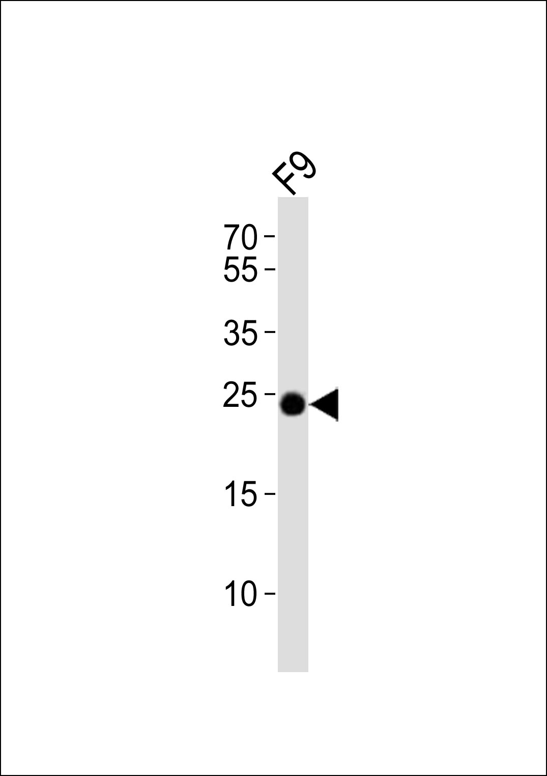 (Mouse) Eras (N-term)