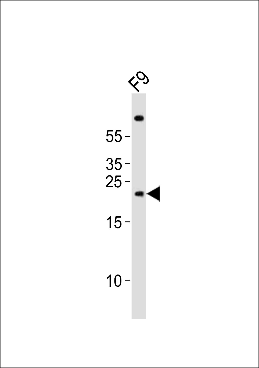 (Mouse) Cldn6