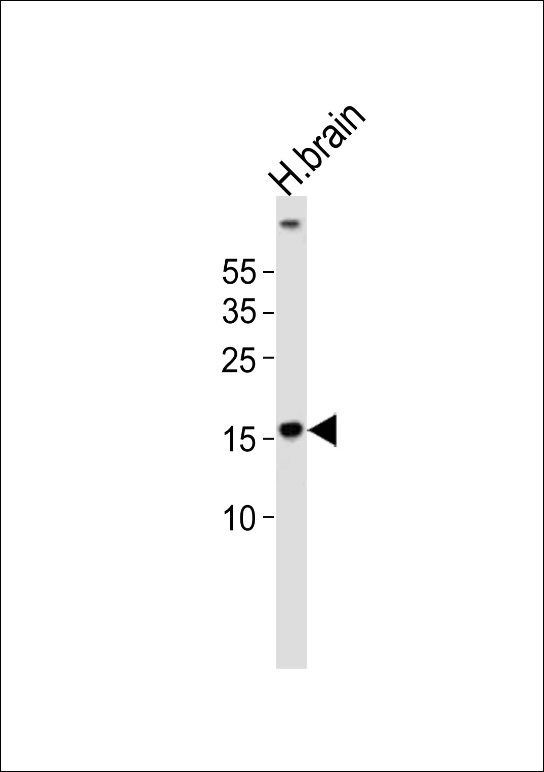 (DANRE)  map1lc3a (N-term)