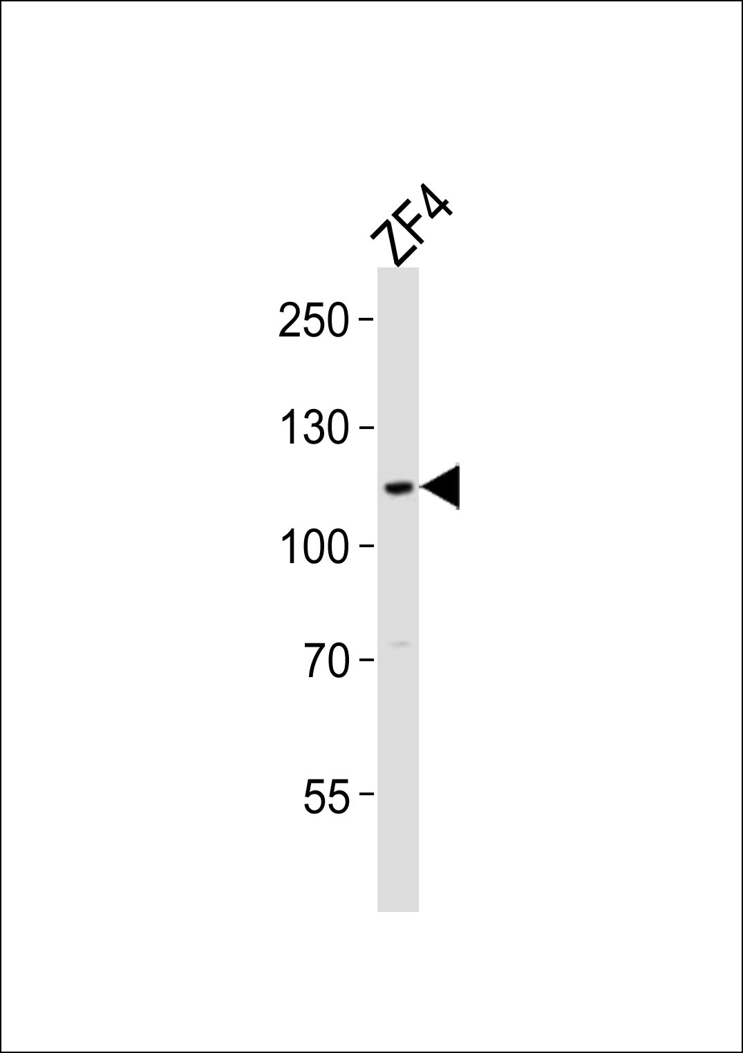 (DANRE) sh3bp4a (N-term)