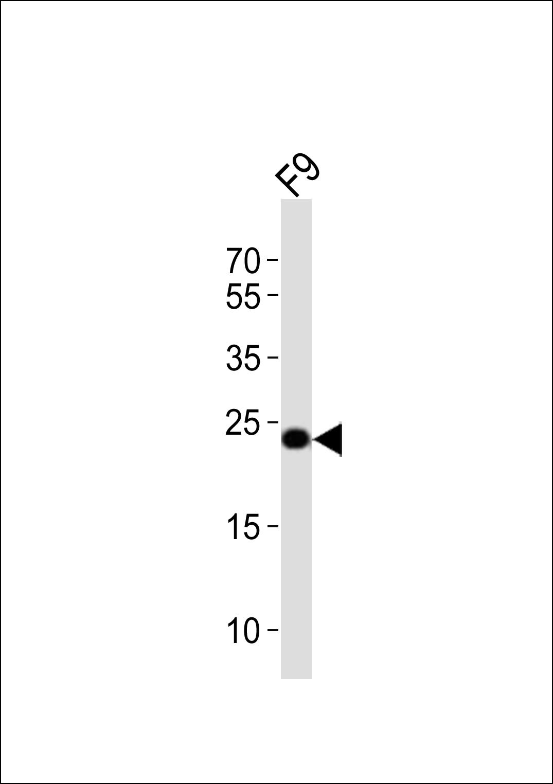 (Mouse) Eras (N-term)