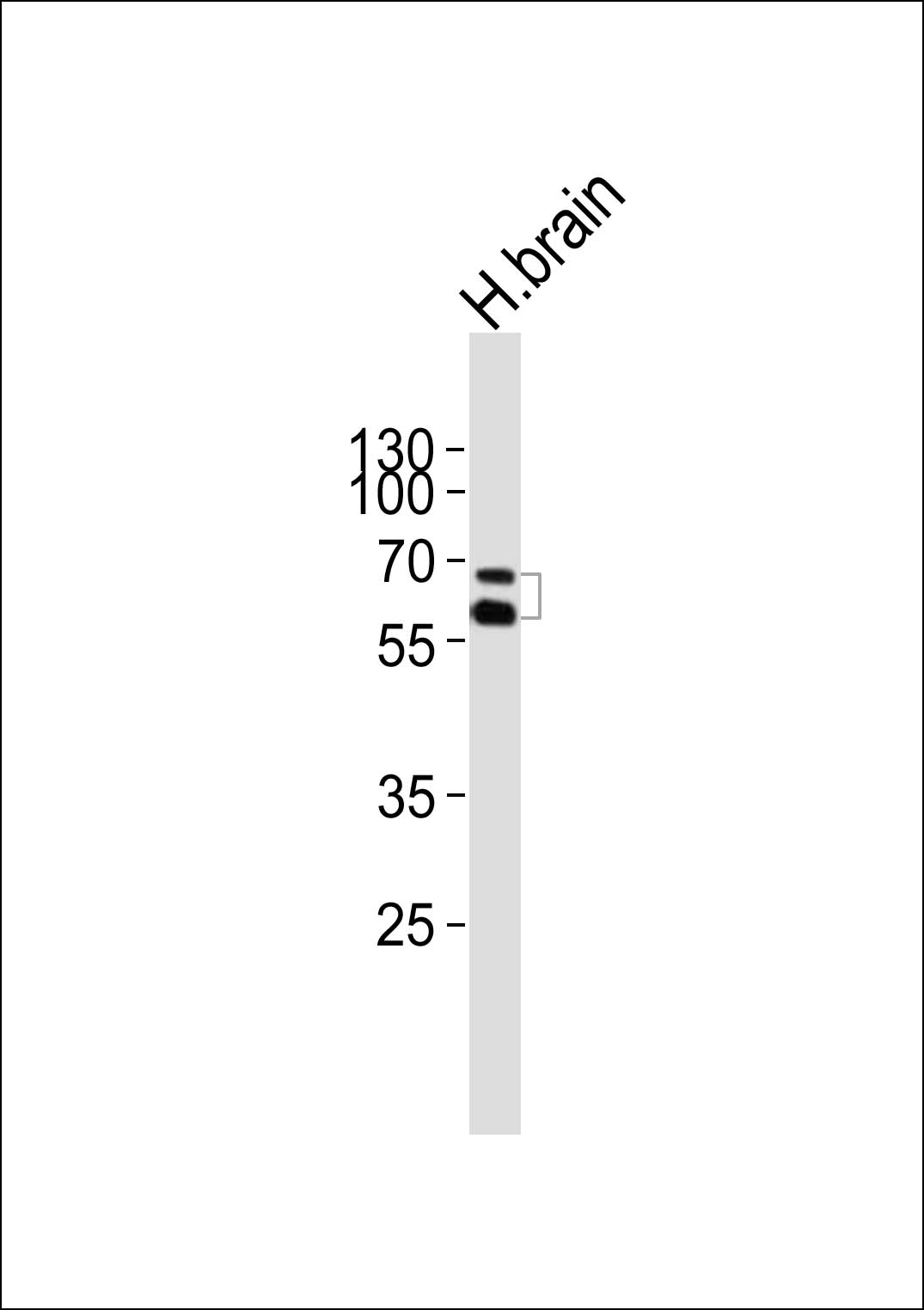 NR4A2