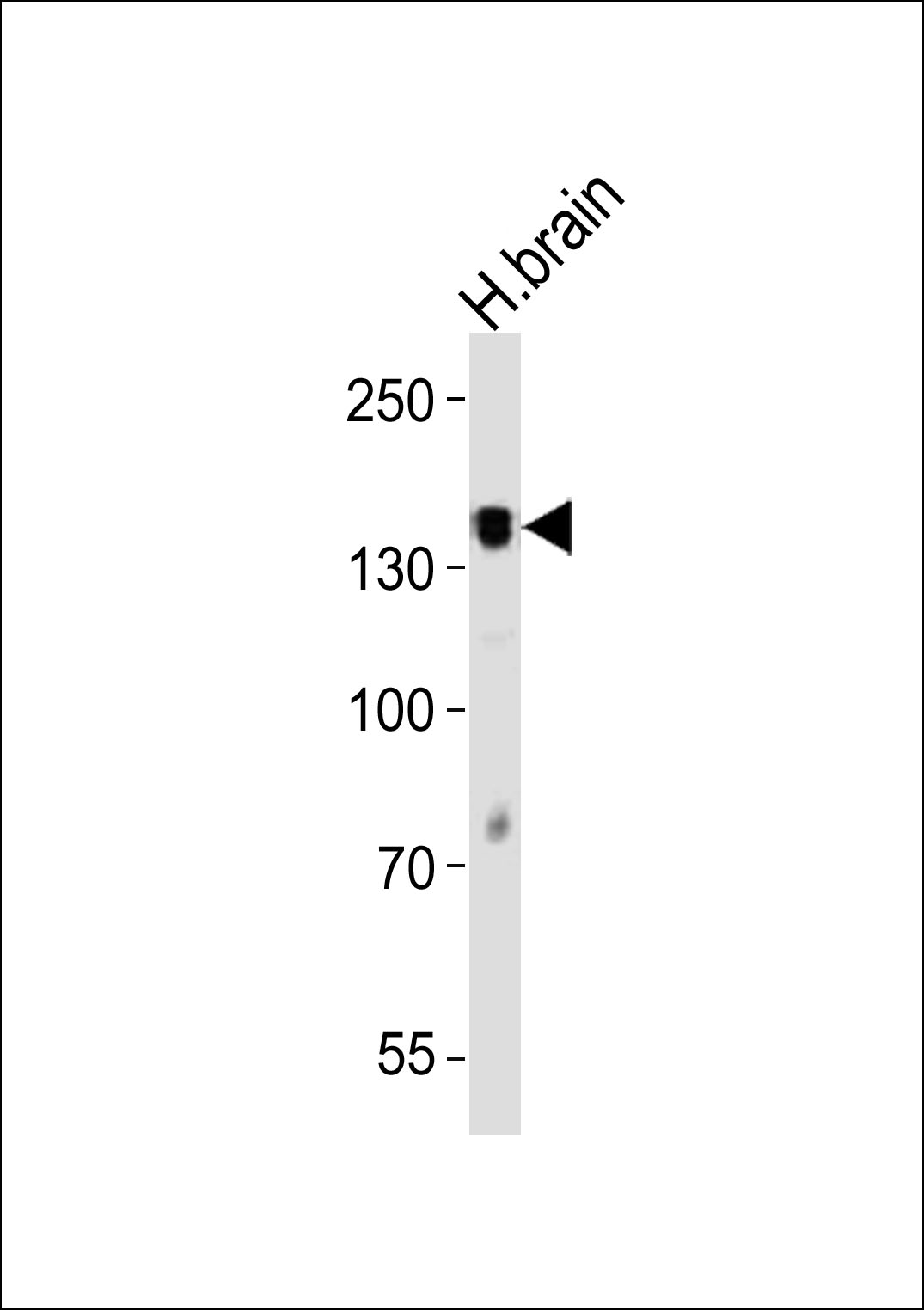 PTPRZ1 (N-term)