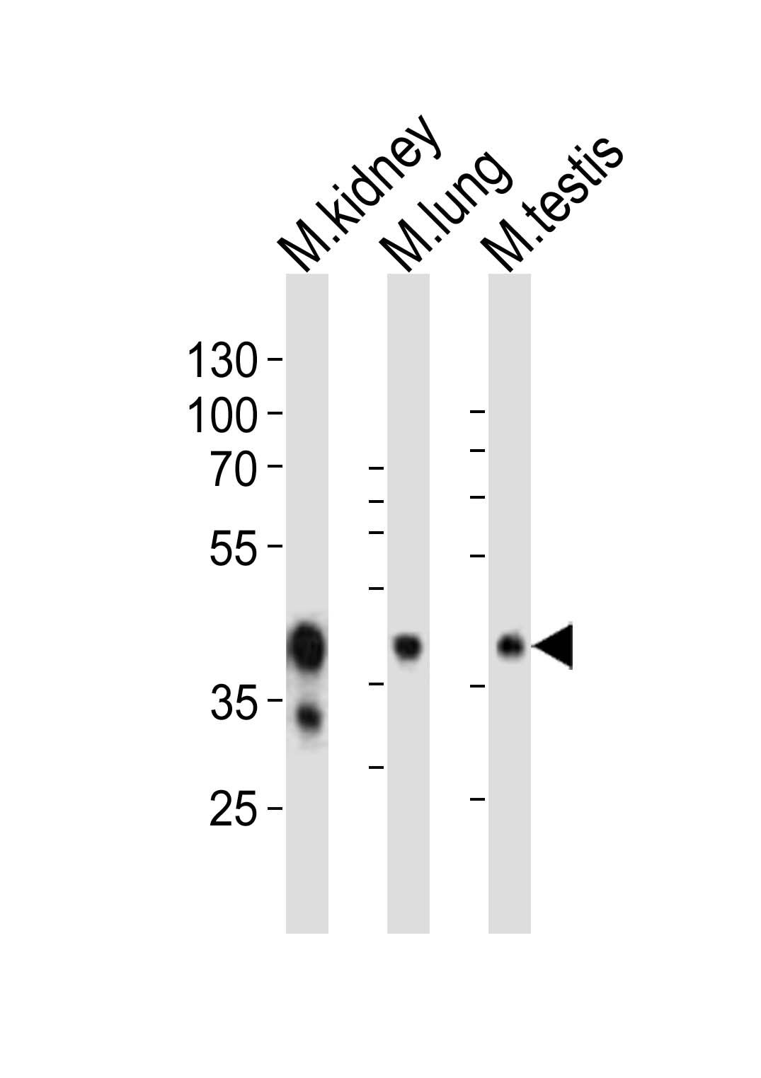 (Mouse) Epcam