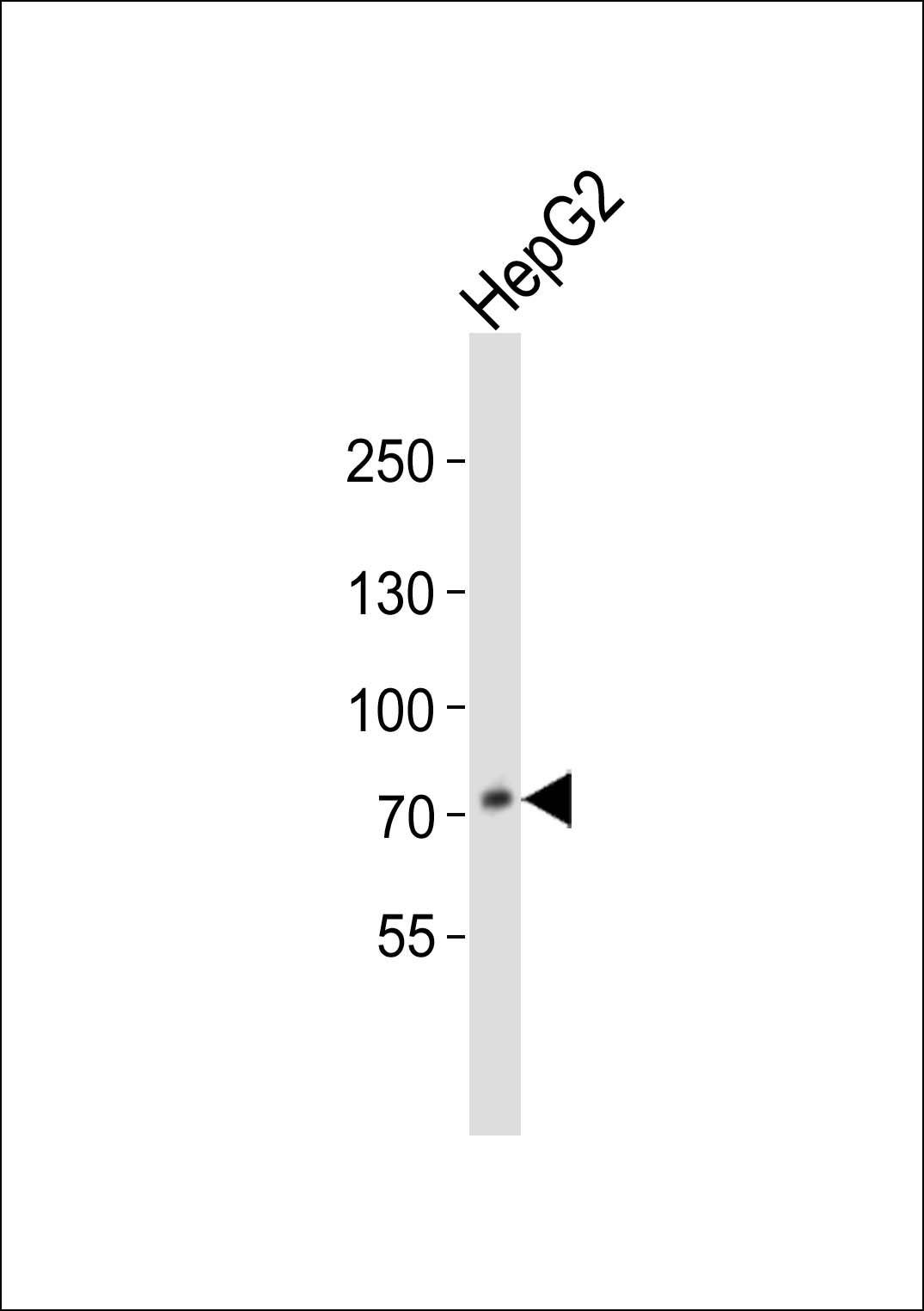 PCSK9