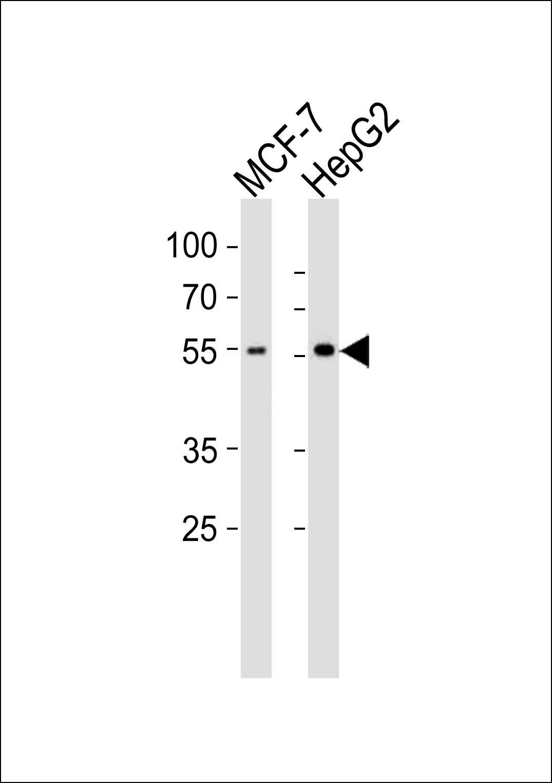 CYP2W1 (N-term)