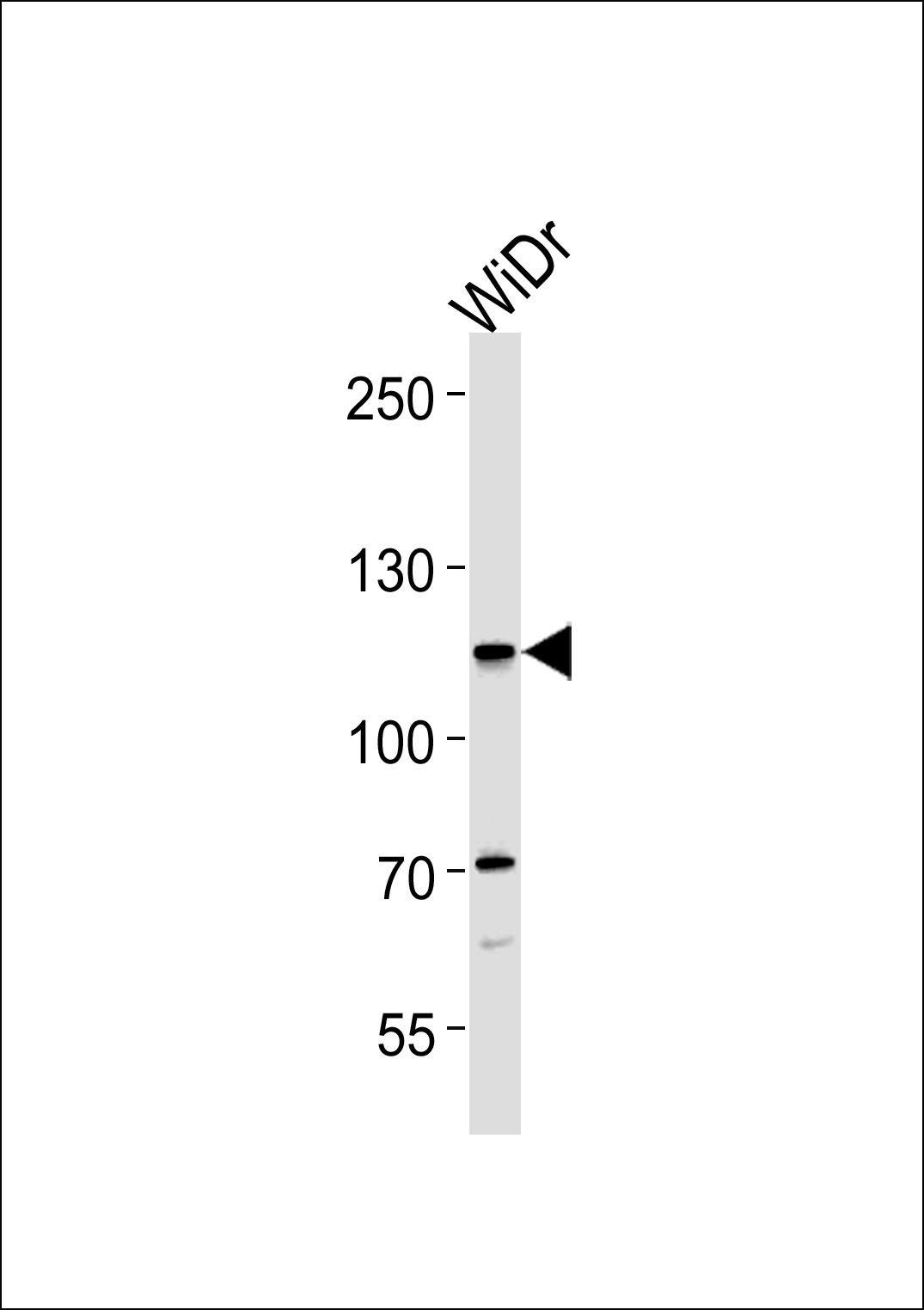 Rabbit Polyclonal Antibody to CARD6