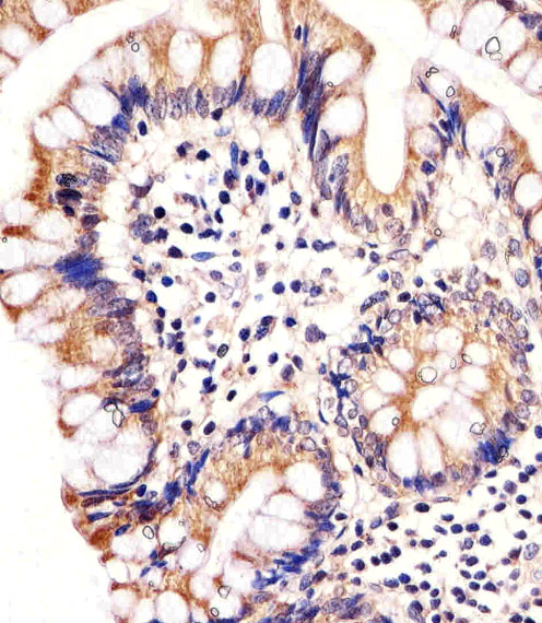 Rabbit Polyclonal Antibody to CARD6