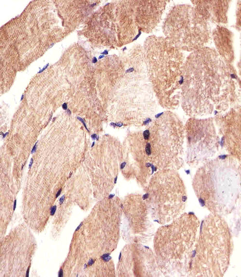 Rabbit Polyclonal Antibody to CARD6