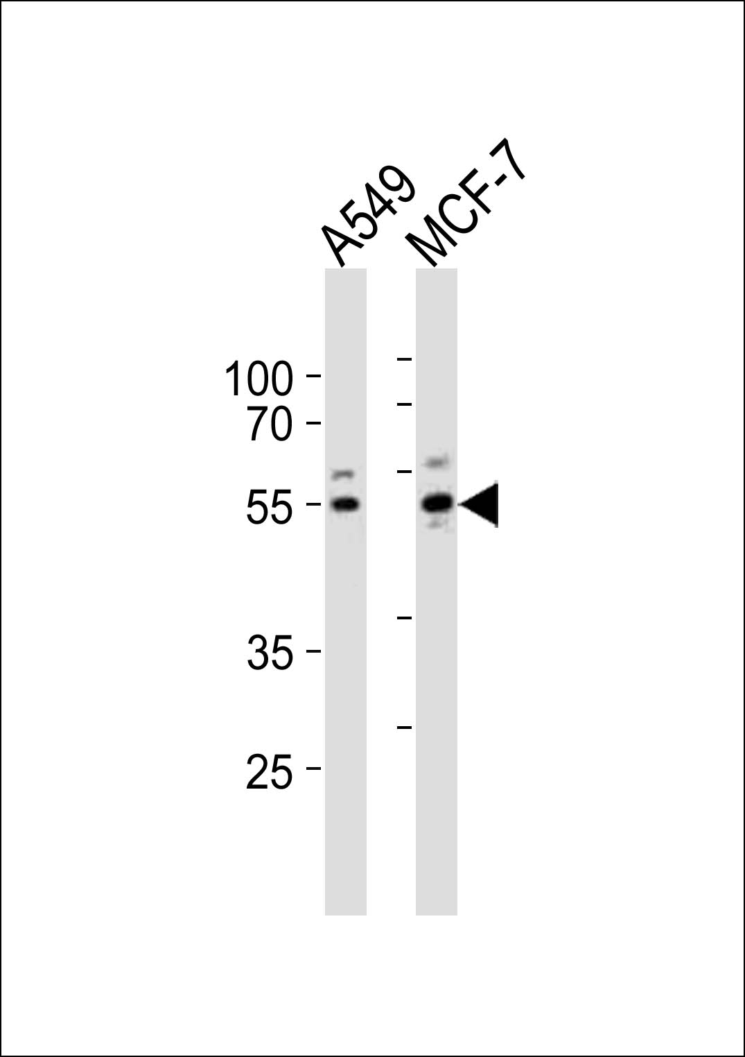 PPP2R2C (N-term)