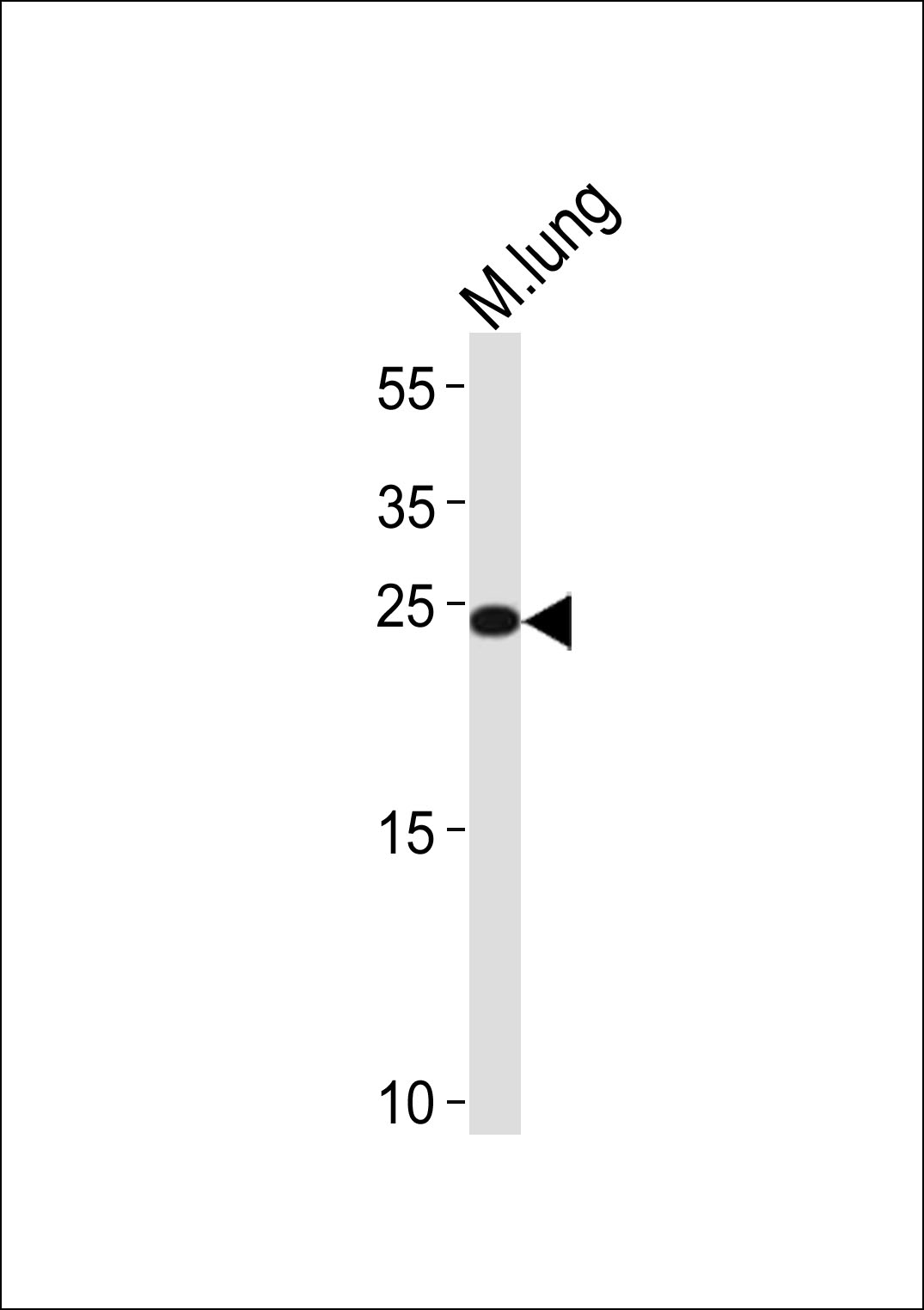 (Mouse) Scx (N-term)