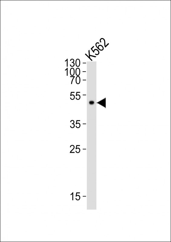 ATG4A