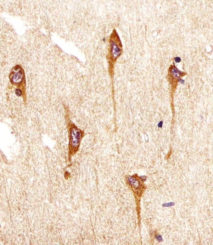 Mouse Monoclonal Antibody to NTRK2