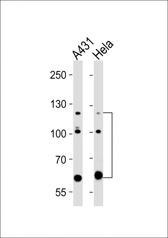 Mouse Monoclonal Antibody to ABL2