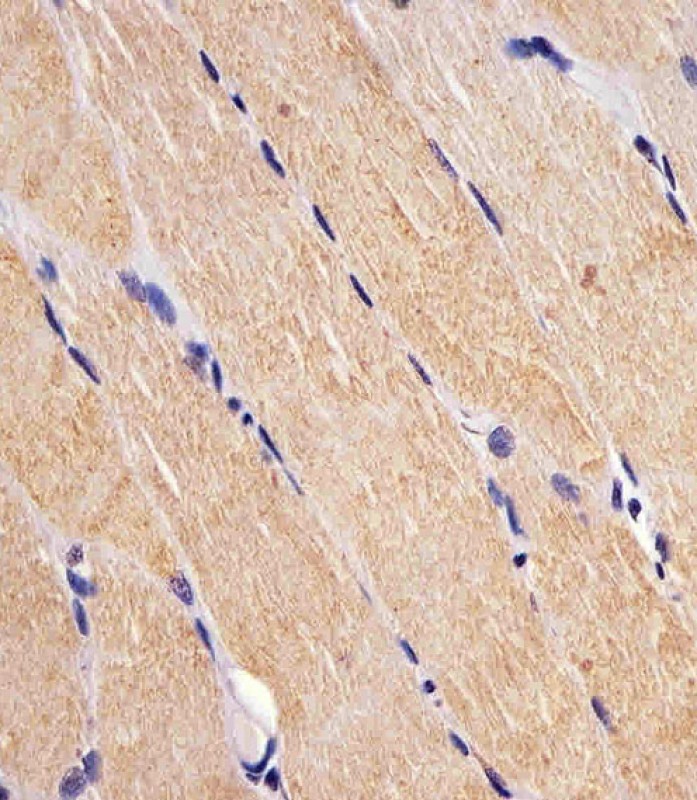 Mouse Monoclonal Antibody to FES