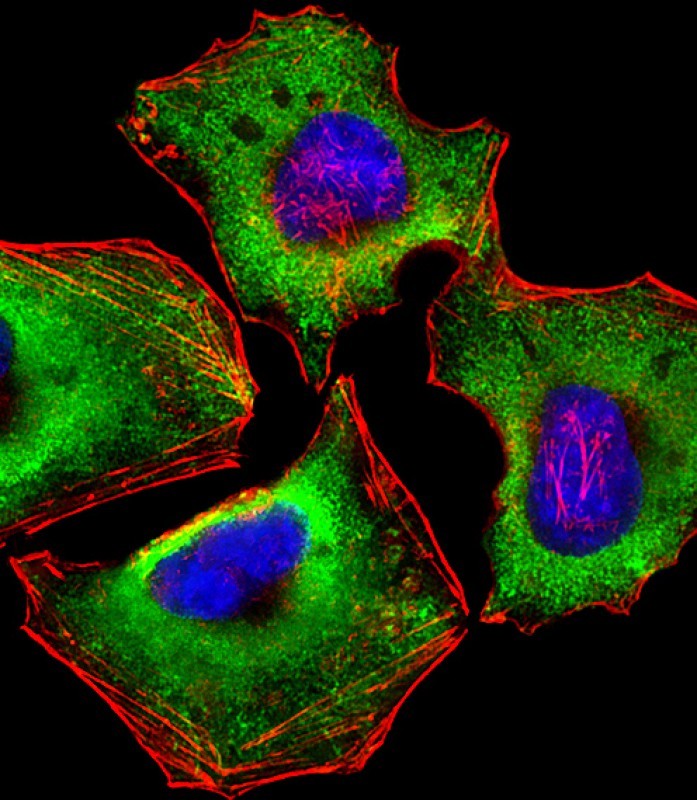 Mouse Monoclonal Antibody to ZAP70