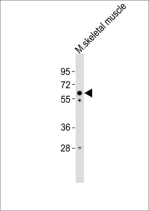 Rabbit Polyclonal Antibody to (Mouse) Smarcd3