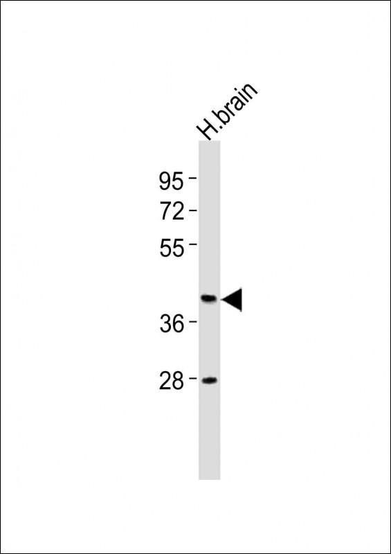 CNR2 (N-term)