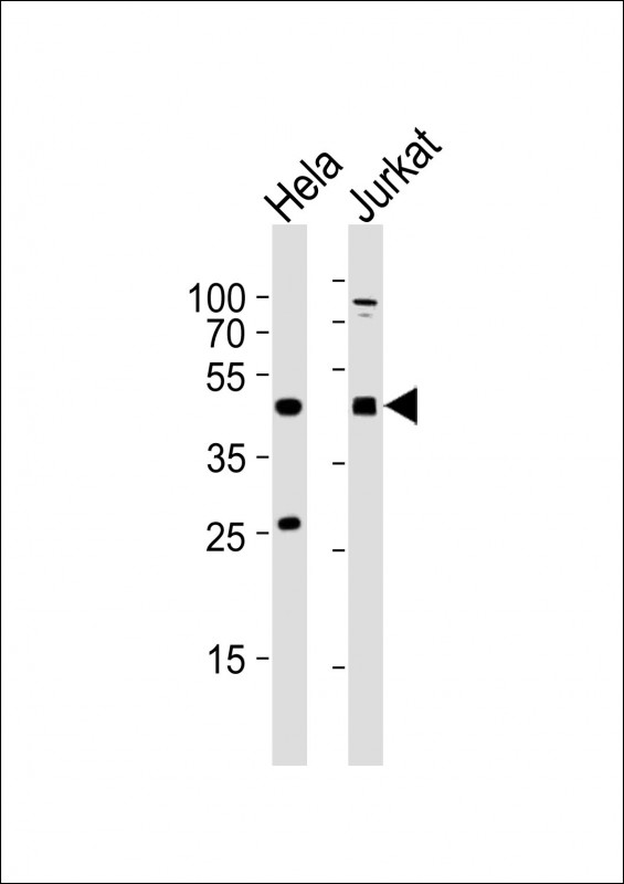 AVPR2