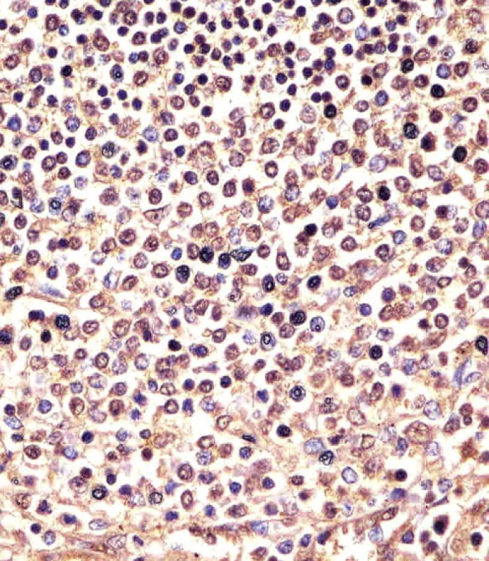 Rabbit Polyclonal Antibody to PSMB9