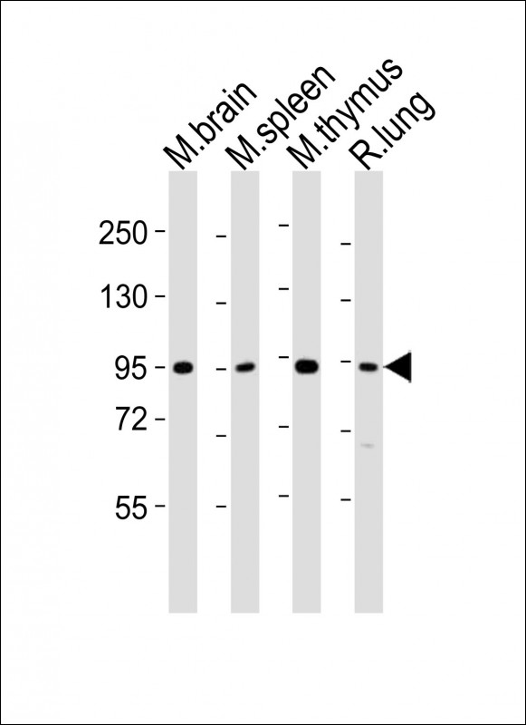 Rabbit Polyclonal Antibody to (Mouse) Med15